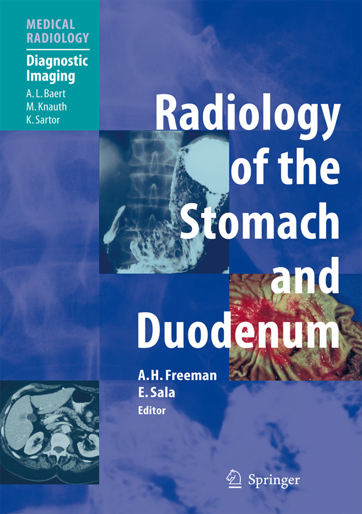 Radiology of the Stomach and Duodenum