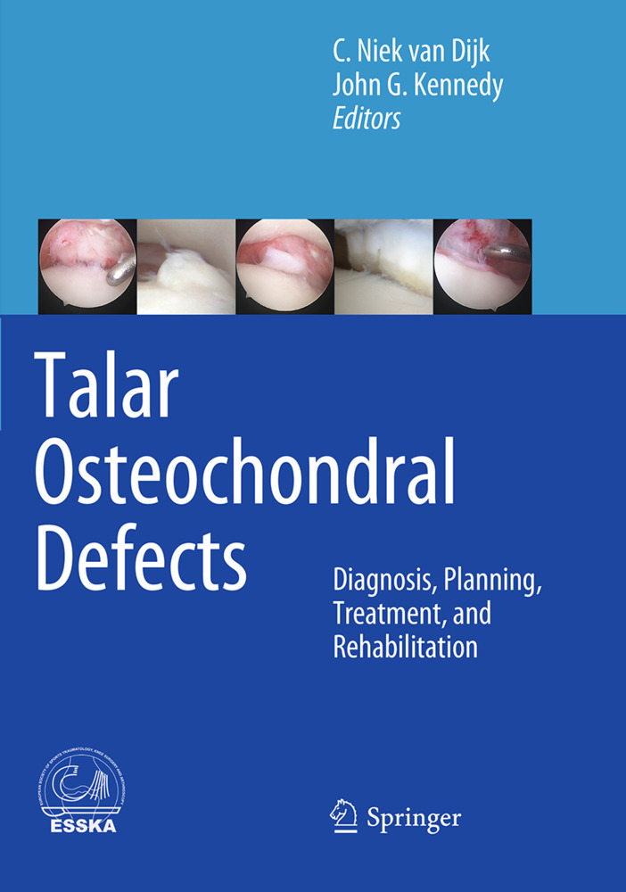 Talar Osteochondral Defects