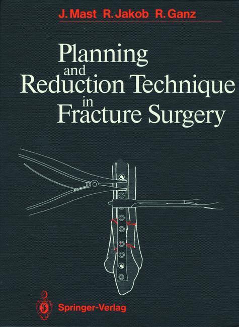 Planning and Reduction Technique in Fracture Surgery