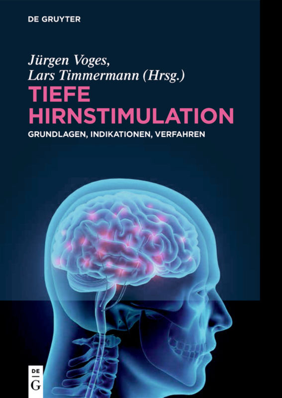 Tiefe Hirnstimulation