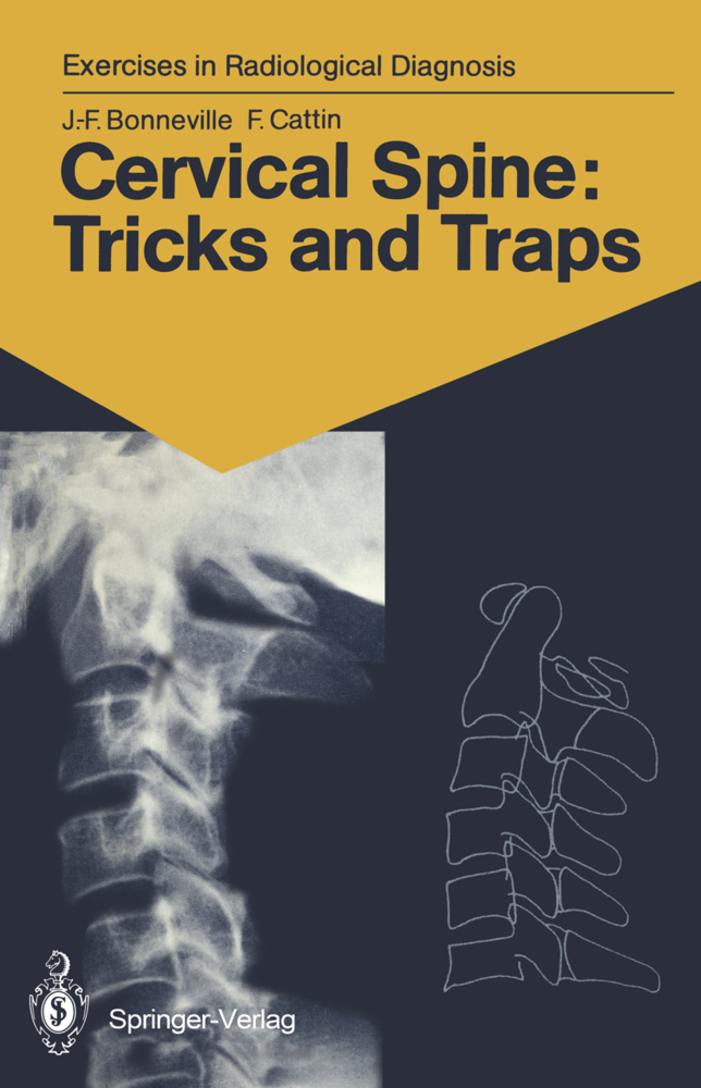 Cervical Spine: Tricks and Traps