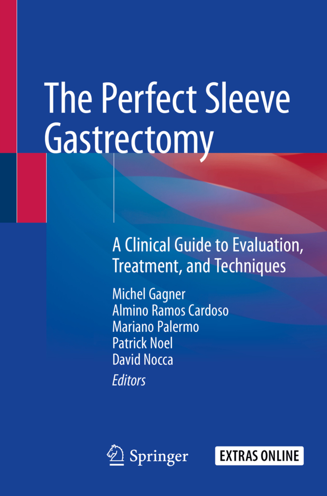 The Perfect Sleeve Gastrectomy