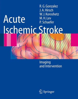 Acute Ischemic Stroke