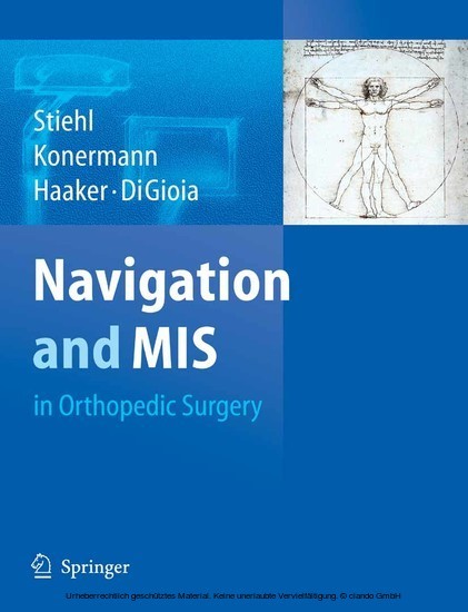 Navigation and MIS in Orthopedic Surgery