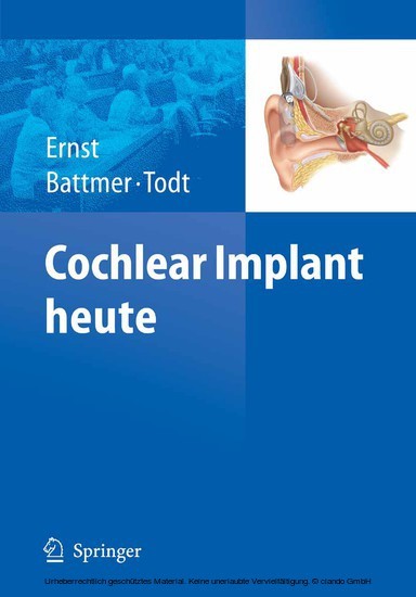 Cochlear Implant heute