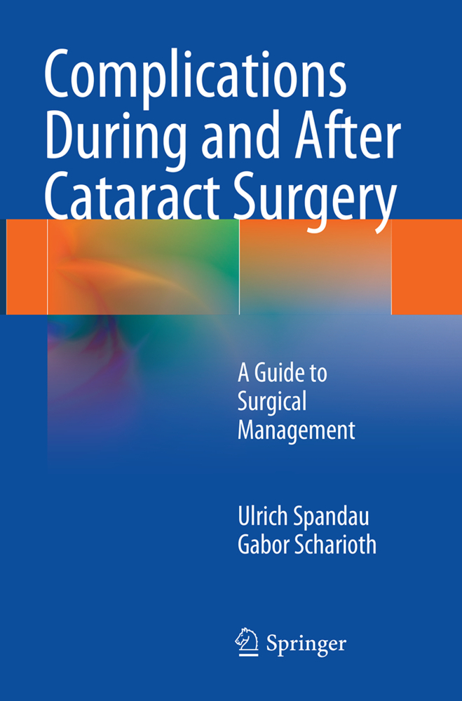 Complications During and After Cataract Surgery