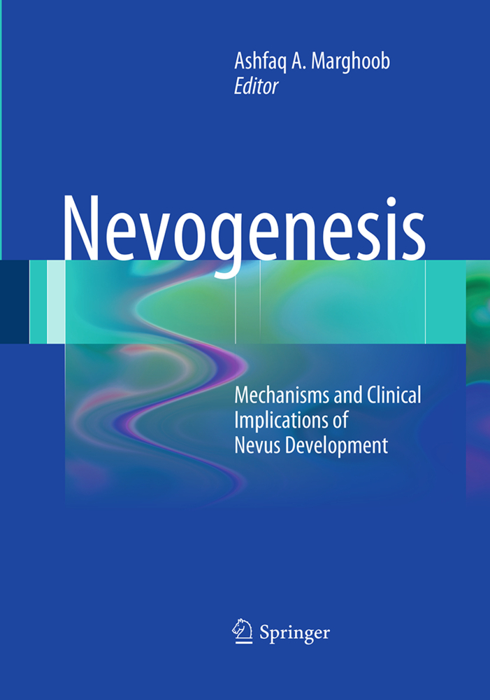 Nevogenesis