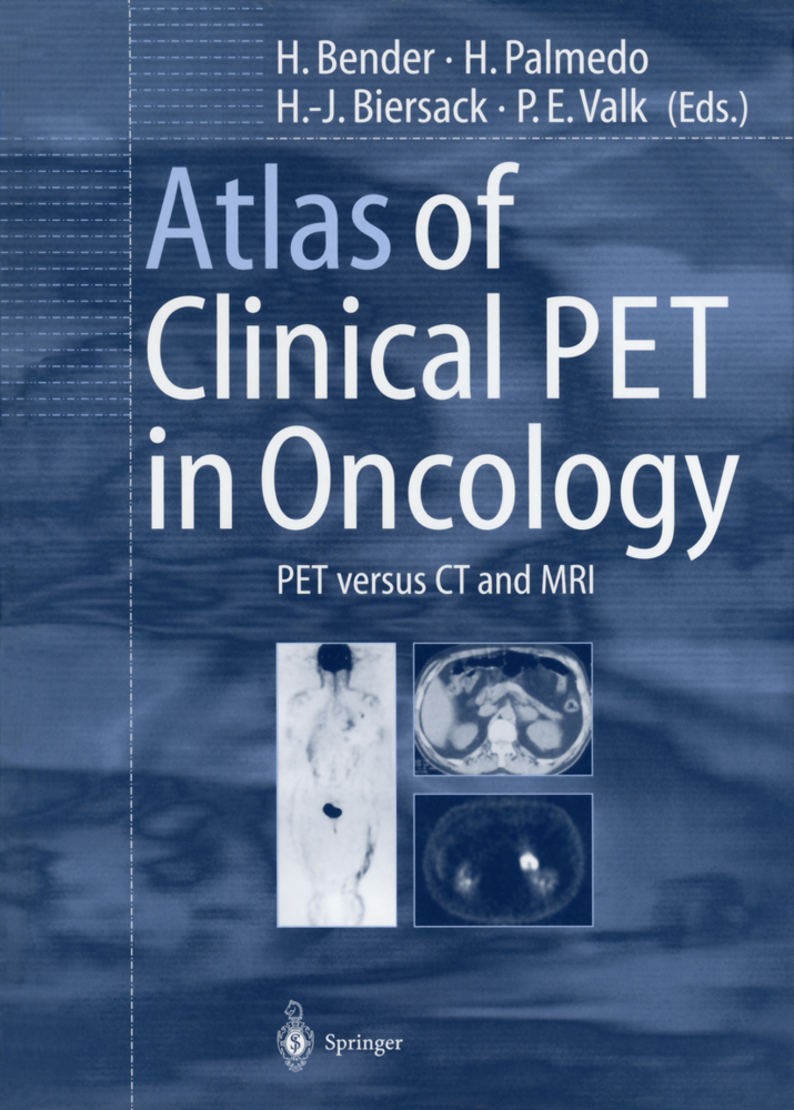 Atlas of Clinical PET in Oncology