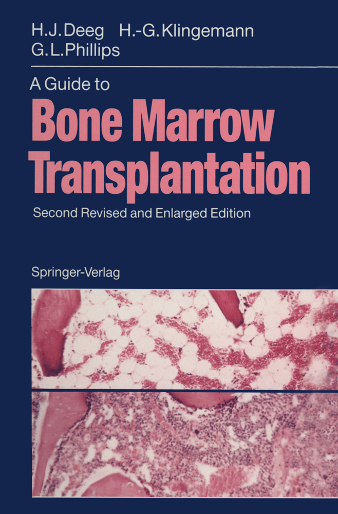 A Guide to Bone Marrow Transplantation