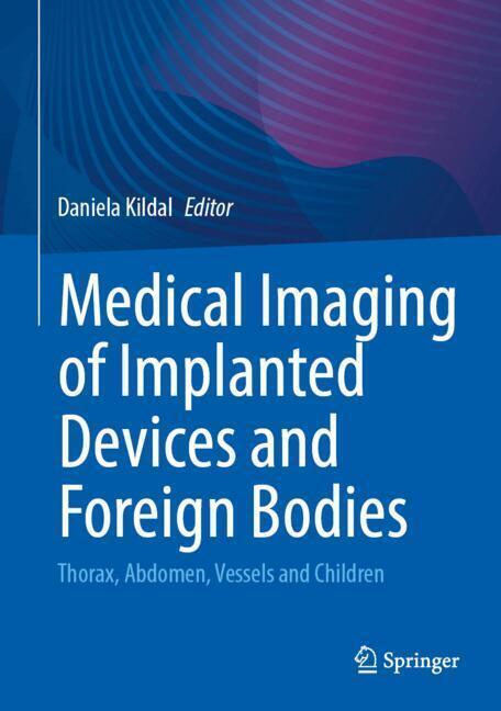 Medical Imaging of Implanted Devices and Foreign Bodies