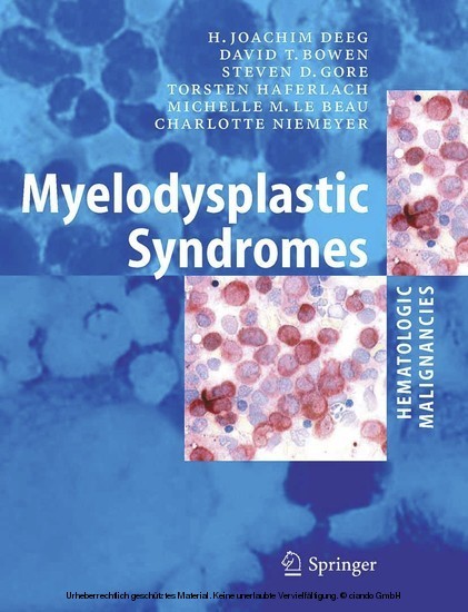 Myelodysplastic  Syndromes