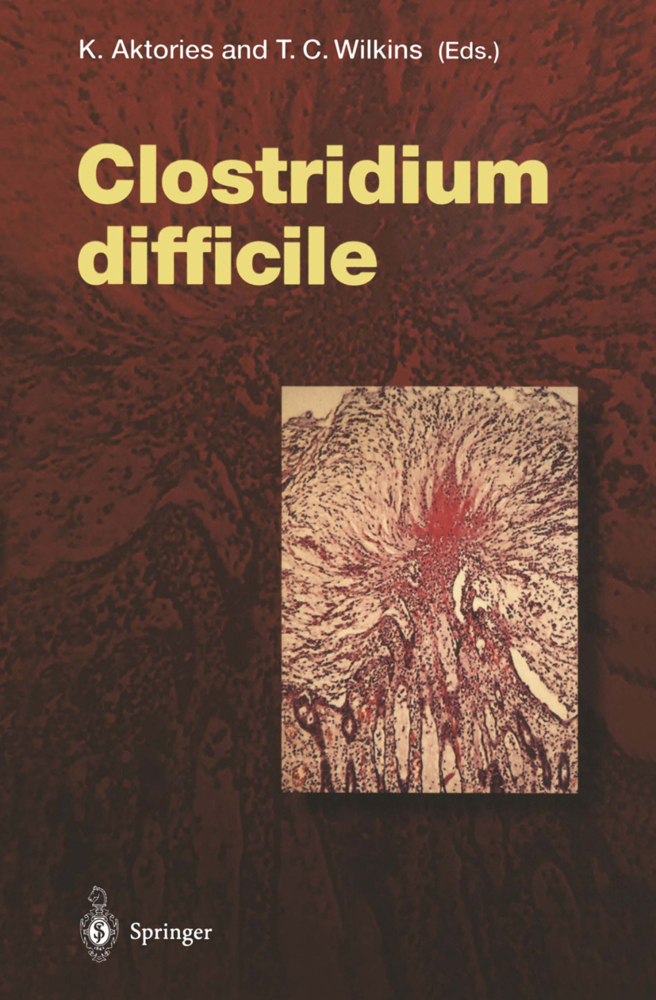 Clostridium difficile