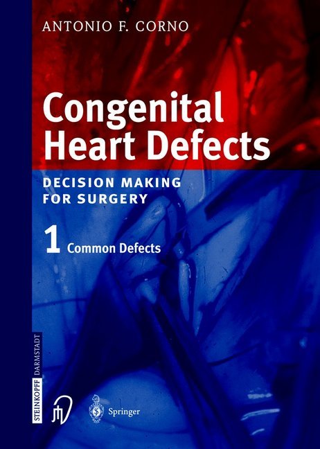 Congenital Heart Defects