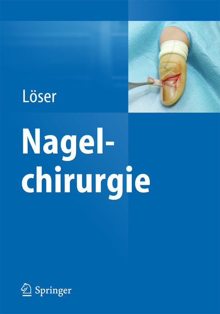 Nagelchirurgie