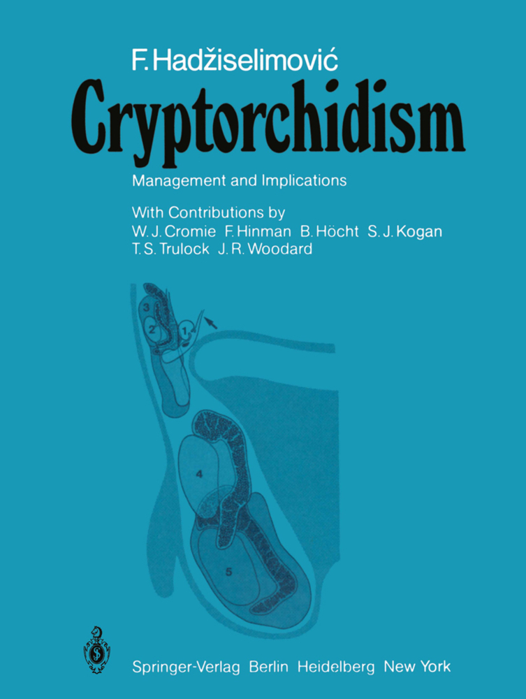 Cryptorchidism