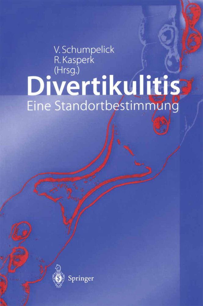 Divertikulitis