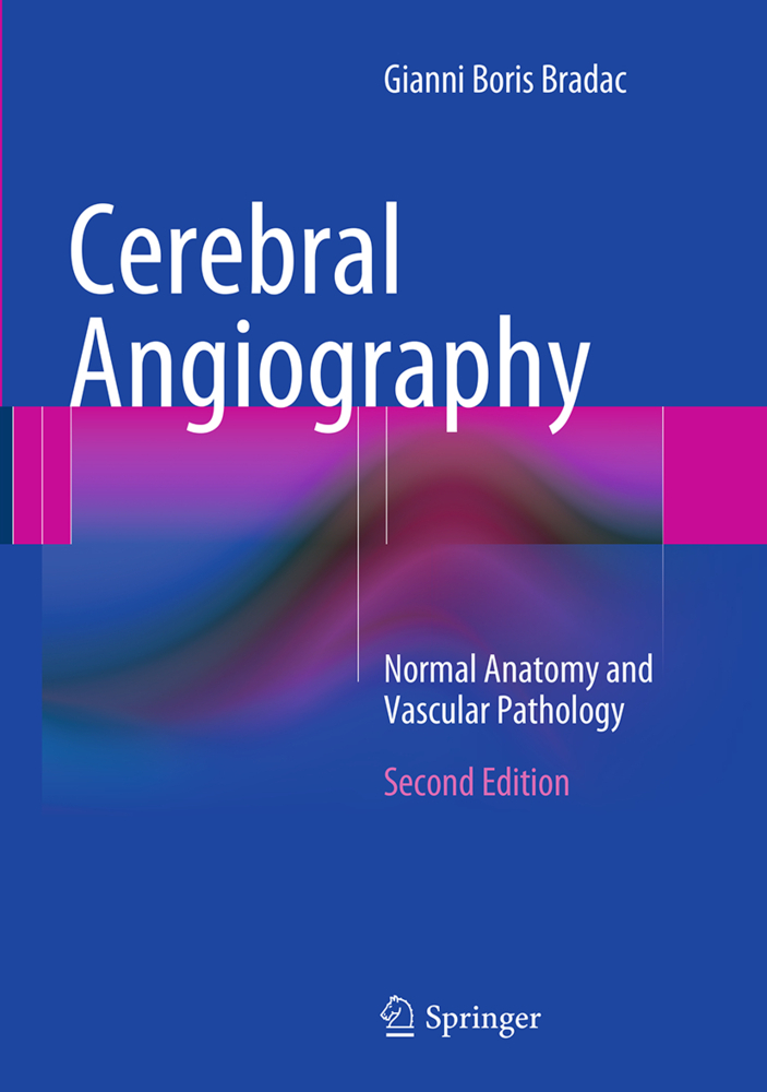 Cerebral Angiography