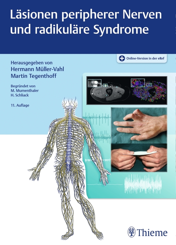 Läsionen peripherer Nerven und radikuläre Syndrome