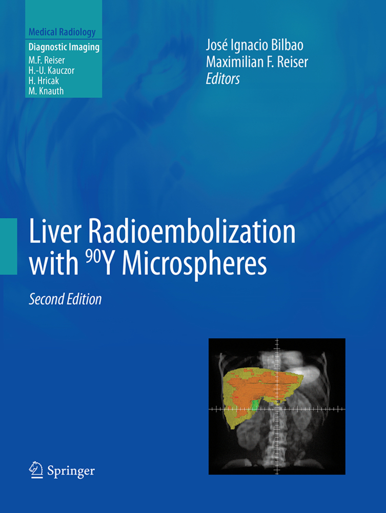 Liver Radioembolization with 90Y Microspheres