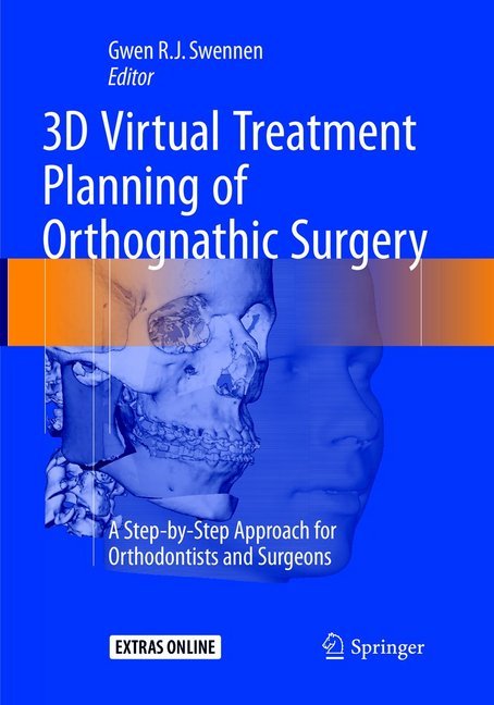 3D Virtual Treatment Planning of Orthognathic Surgery
