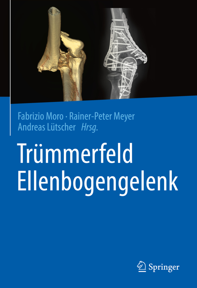 Trümmerfeld Ellenbogengelenk