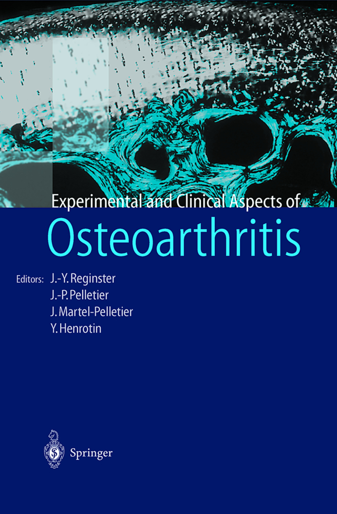 Osteoarthritis