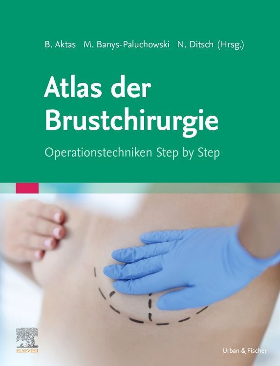 Atlas der Brustchirurgie