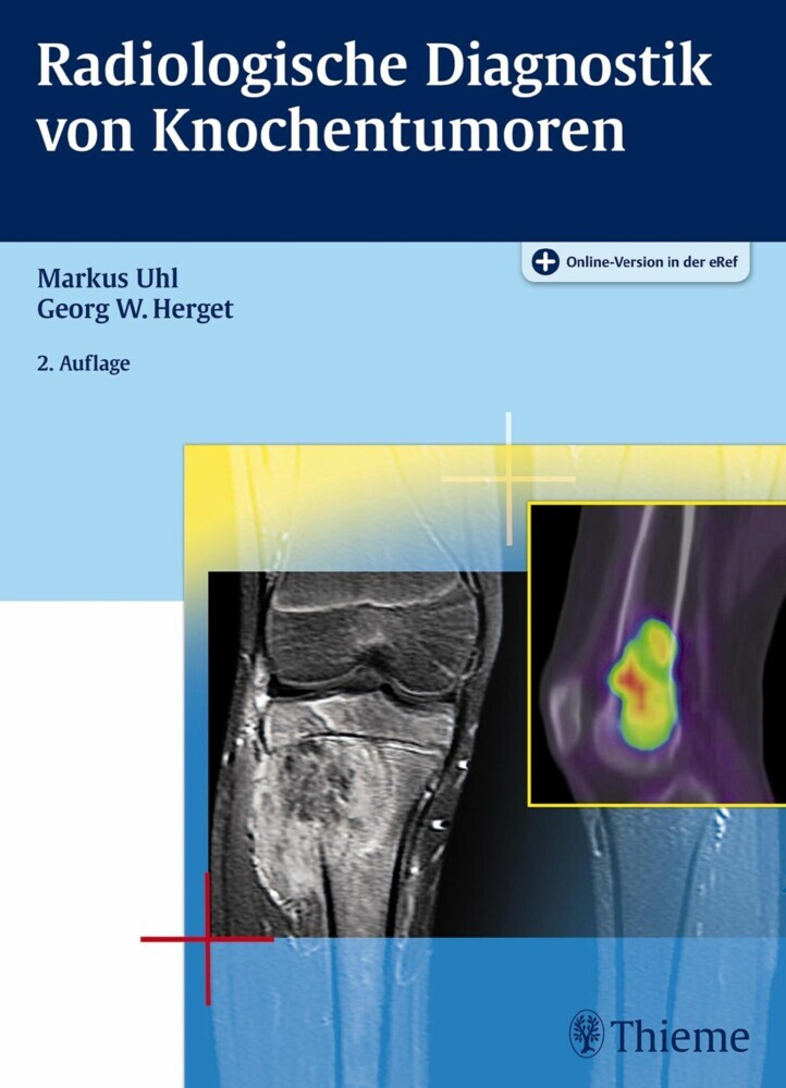 Radiologische Diagnostik von Knochentumoren