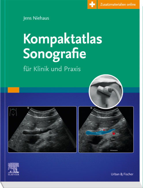 Kompaktatlas Sonografie