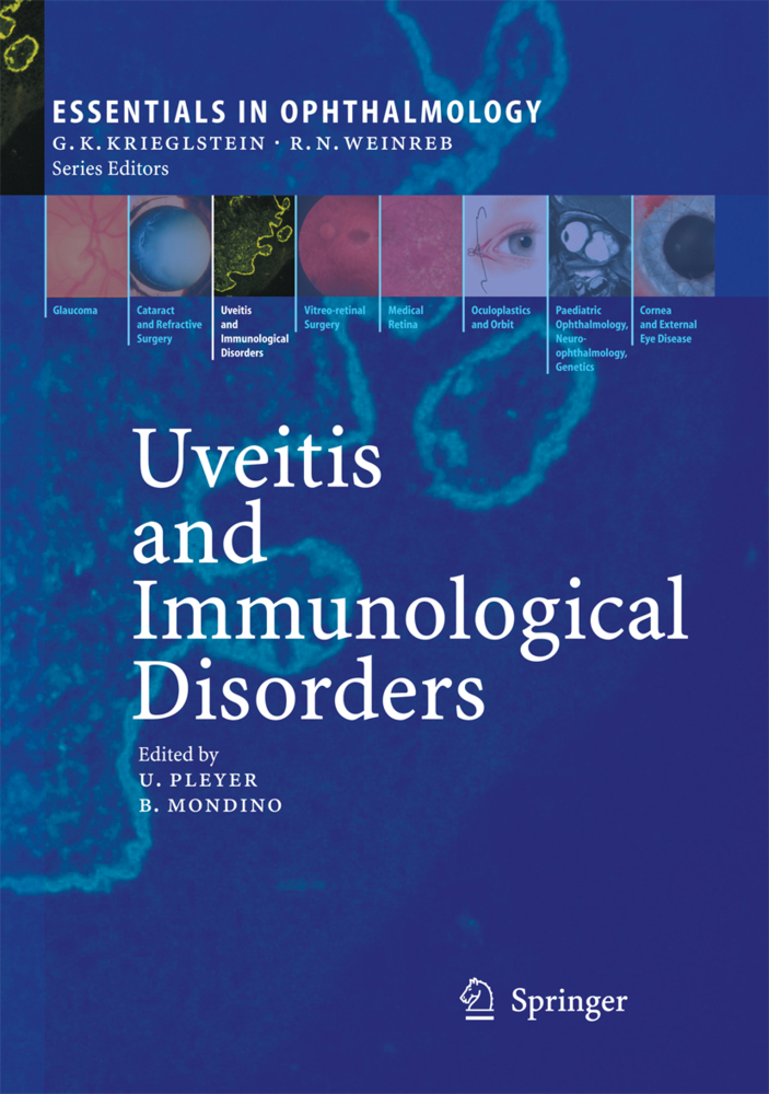 Uveitis and Immunological Disorders