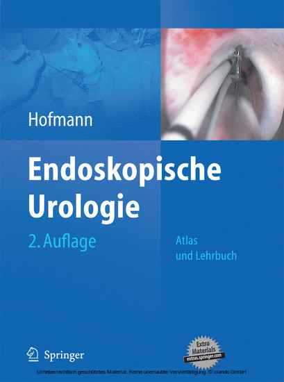 Endoskopische Urologie