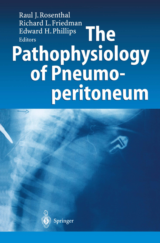 The Pathophysiology of Pneumoperitoneum