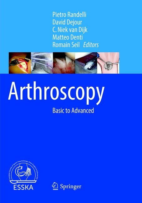 Arthroscopy