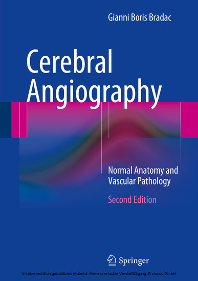 Cerebral Angiography