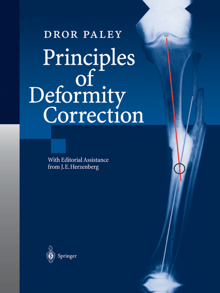 Principles of Deformity Correction, 2 Pts.