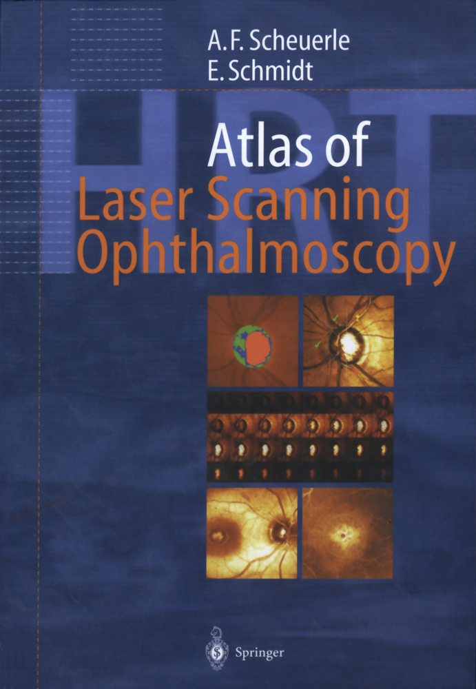 Atlas of Laser Scanning Ophtalmoscopy