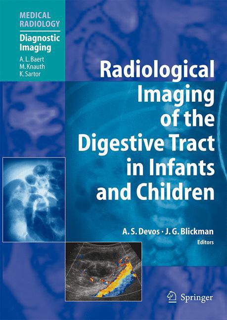 Radiological Imaging of the Digestive Tract in Infants and Children