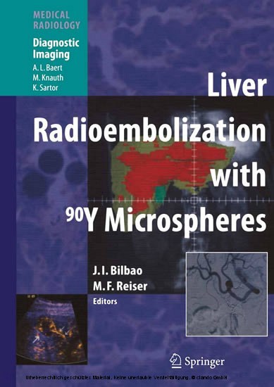 Liver Radioembolization with 90Y Microspheres