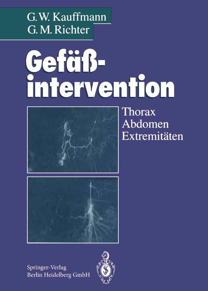 Gefäßintervention