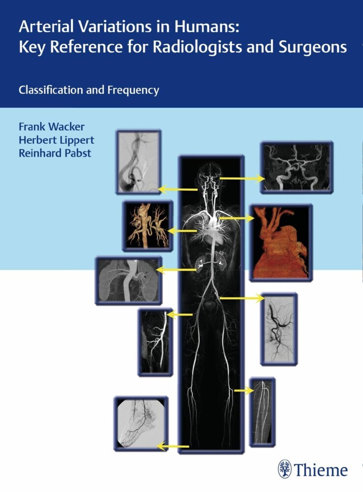 Arterial Variations in Humans: Key Reference for Radiologists and Surgeons