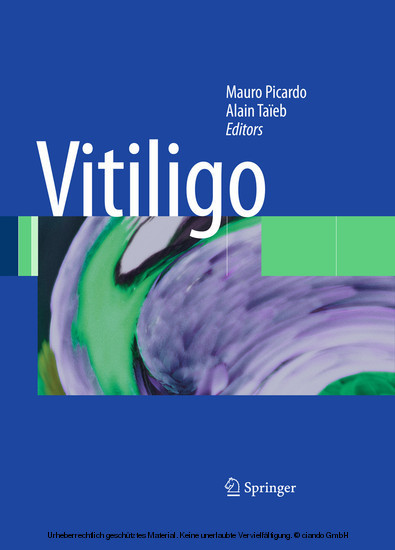 Vitiligo