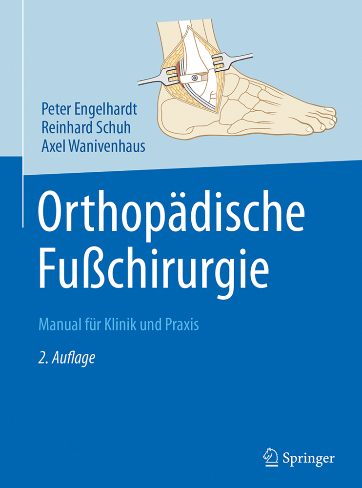 Orthopädische Fußchirurgie