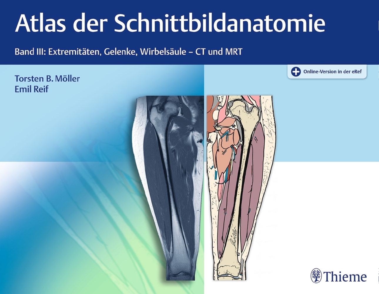 Atlas der Schnittbildanatomie. Bd.3