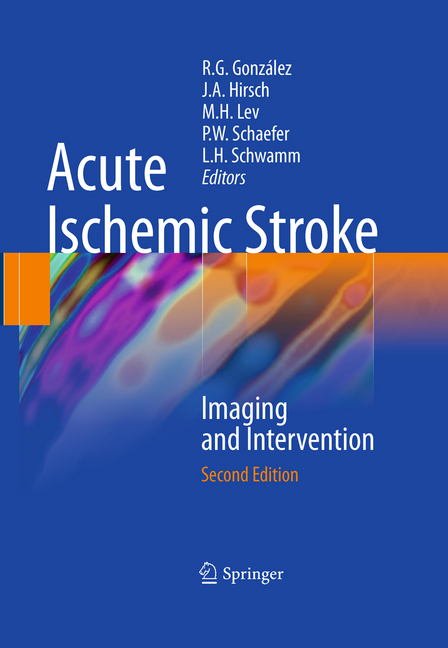 Acute Ischemic Stroke