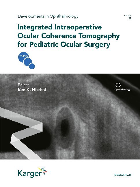 Integrated Intraoperative Ocular Coherence Tomography for Pediatric Ocular Surgery