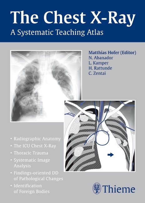 The Chest X-Ray