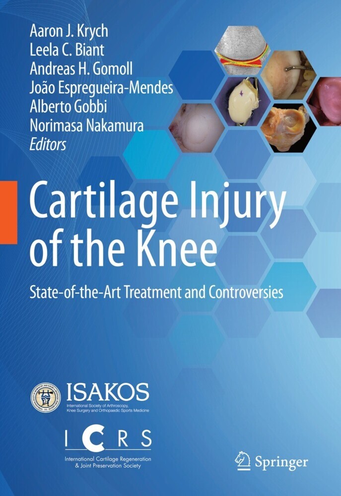 Cartilage Injury of the Knee