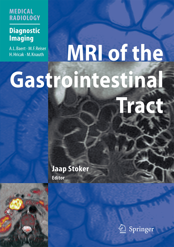 MRI of the Gastrointestinal Tract