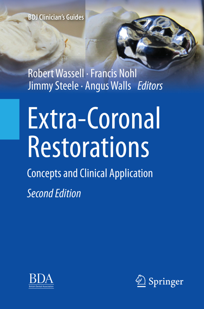 Extra-Coronal Restorations