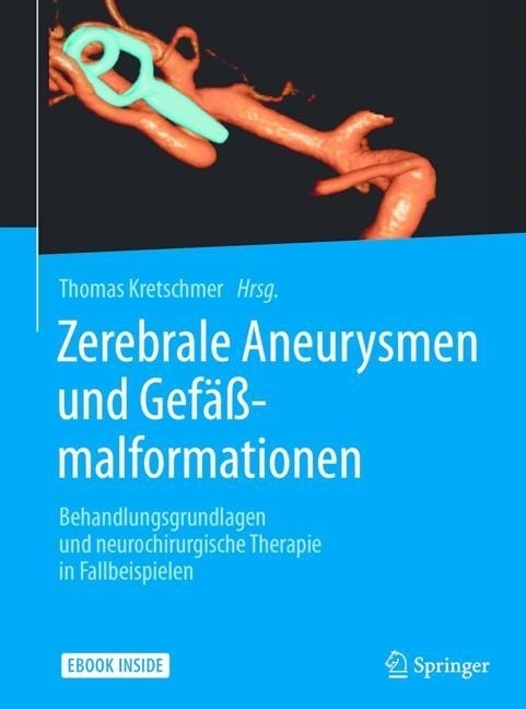 Zerebrale Aneurysmen und Gefäßmalformationen